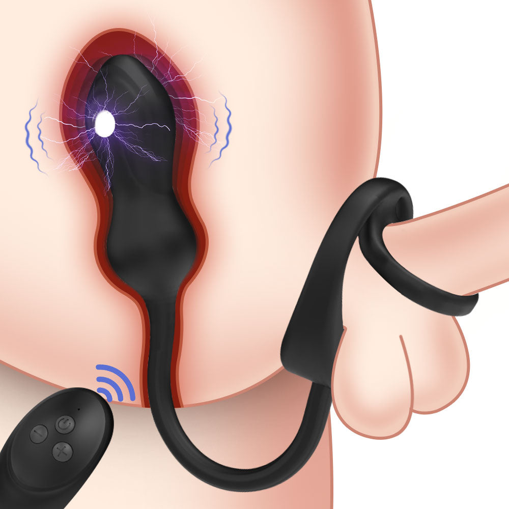 Remote Control Vibrating Cock Ring & Prostate Massager – Electro-Stimulation Male Sex Toys